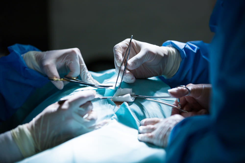 Colocación de gastrostomía en CDMX y Estado de México con especialistas en cirugía general