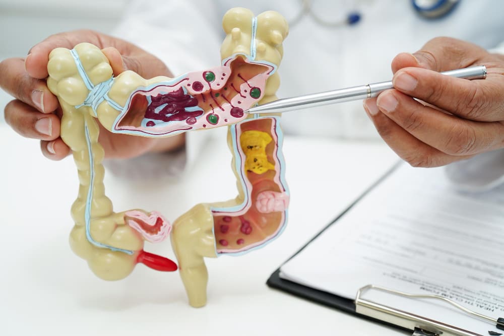 Valoración de oclusión intestinal en CDMX y Estado de México con especialistas en cirugía general